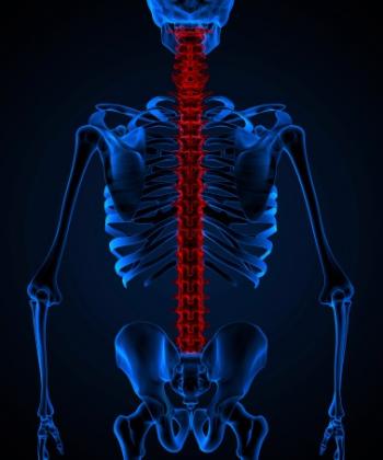 All About Sciatica From a Herniated Disc